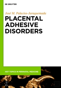 Bertrand.pt - Placental Adhesive Disorders