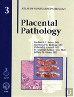 Bertrand.pt - Placental Pathology