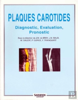 Bertrand.pt - Plaques Carotides