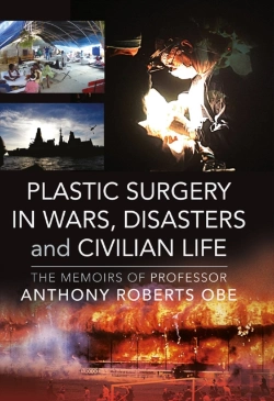 Bertrand.pt - Plastic Surgery In Wars, Disasters And Civilian Life