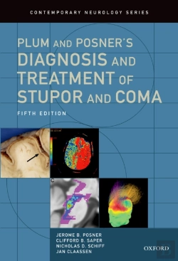 Bertrand.pt - Plum And Posner'S Diagnosis And Treatment Of Stupor And Coma