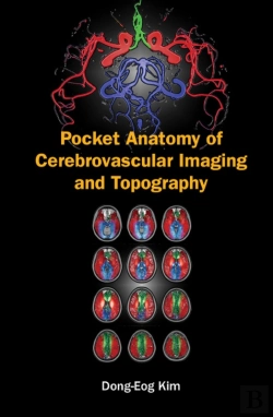 Bertrand.pt - Pocket Anatomy Of Cerebrovascular Imaging And Topography