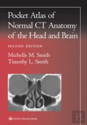 Pocket Atlas Of Normal Ct Anatomy Of The Head And Brain
