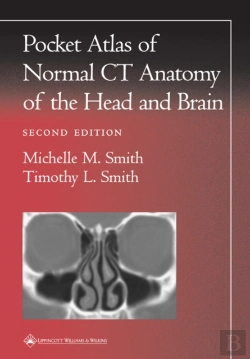 Bertrand.pt - Pocket Atlas Of Normal Ct Anatomy Of The Head And Brain