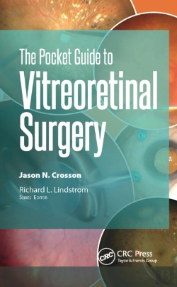 Bertrand.pt - Pocket Guide To Vitreoretinal Surgery