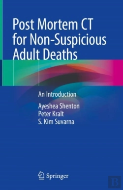 Bertrand.pt - Post Mortem Ct For Non-Suspicious Adult Deaths