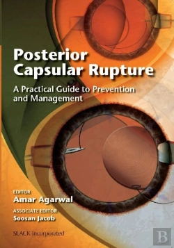 Bertrand.pt - Posterior Capsular Rupture