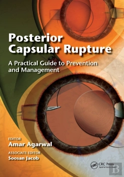 Bertrand.pt - Posterior Capsular Rupture