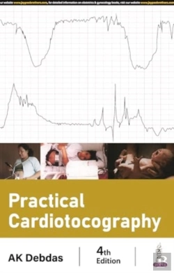 Bertrand.pt - Practical Cardiotocography