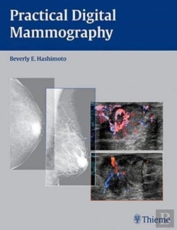 Bertrand.pt - Practical Digital Mammography