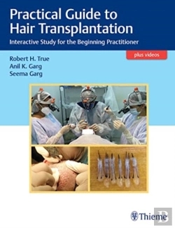 Bertrand.pt - Practical Guide To Hair Transplantation