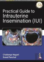 Practical Guide To Intrauterine Insemination (Iui)