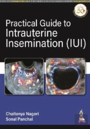 Practical Guide To Intrauterine Insemination (Iui)
