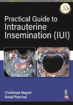 Bertrand.pt - Practical Guide To Intrauterine Insemination (Iui)