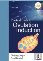 Practical Guide To Ovulation Induction