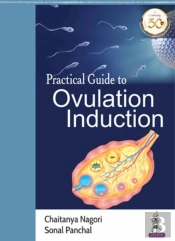 Practical Guide To Ovulation Induction