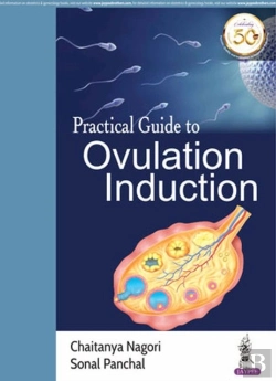 Bertrand.pt - Practical Guide To Ovulation Induction