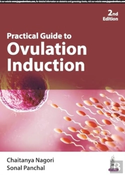 Bertrand.pt - Practical Guide To Ovulation Induction
