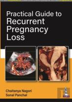 Practical Guide To Recurrent Pregnancy Loss