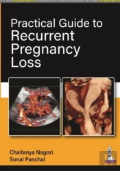 Practical Guide To Recurrent Pregnancy Loss