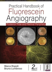 Practical Handbook Of Fluorescein Angiography