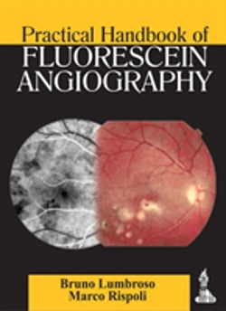 Bertrand.pt - Practical Handbook Of Fluorescein Angiography