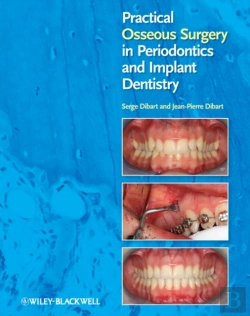Bertrand.pt - Practical Osseous Surgery In Periodontics And Implant Dentistry