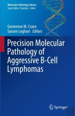 Bertrand.pt - Precision Molecular Pathology Of Aggressive B-Cell Lymphomas