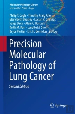 Bertrand.pt - Precision Molecular Pathology Of Lung Cancer