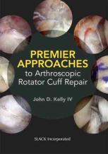 Premier Approaches To Arthroscopic Rotator Cuff Repair