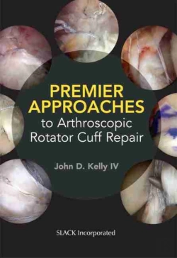 Bertrand.pt - Premier Approaches To Arthroscopic Rotator Cuff Repair