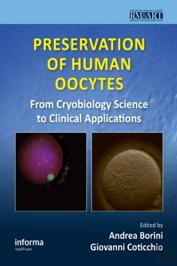 Bertrand.pt - Preservation Of Human Oocytes