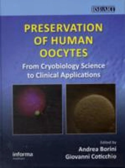 Bertrand.pt - Preservation Of Human Oocytes