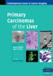 Primary Carcinomas Of The Liver