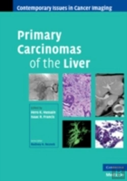 Bertrand.pt - Primary Carcinomas Of The Liver