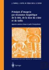 Principes D'Imagerie Par Résonance Magnétique De La Tête, De La Base Du Crâne Et Du Rachis (2e Édition)