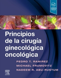 Bertrand.pt - Principios De La Cirugía Ginecológica Oncológica