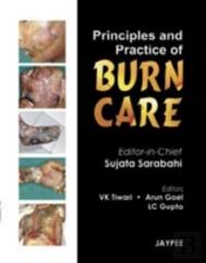 Principles And Practice Of Burn Care