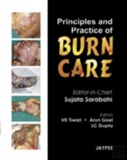 Bertrand.pt - Principles And Practice Of Burn Care
