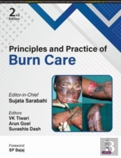 Principles And Practice Of Burn Care