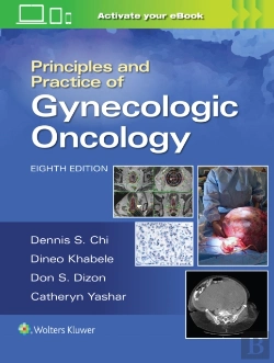 Bertrand.pt - Principles And Practice Of Gynecologic Oncology