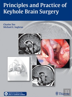 Bertrand.pt - Principles And Practice Of Keyhole Brain Surgery