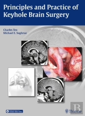 Principles And Practice Of Keyhole Brain Surgery