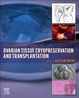Principles And Practice Of Ovarian Tissue Cryopreservation And Transplantation