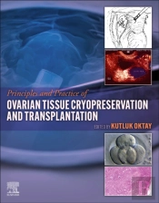 Principles And Practice Of Ovarian Tissue Cryopreservation And Transplantation