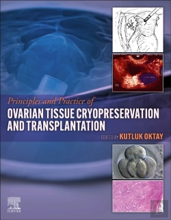 Bertrand.pt - Principles And Practice Of Ovarian Tissue Cryopreservation And Transplantation