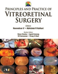 Principles And Practice Of Vitreoretinal Surgery