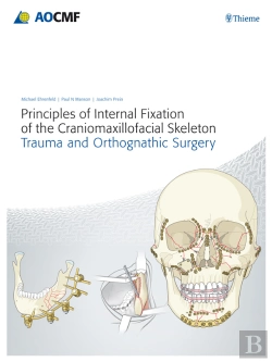 Bertrand.pt - Principles Of Internal Fixation Of The Craniomaxillofacial Skeleton
