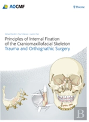 Principles Of Internal Fixation Of The Craniomaxillofacial Skeleton: Trauma & Orthognathic Surgery