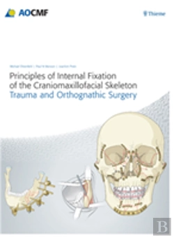 Bertrand.pt - Principles Of Internal Fixation Of The Craniomaxillofacial Skeleton: Trauma & Orthognathic Surgery
